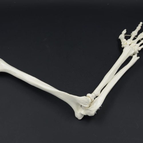 ARM BONE MODEL