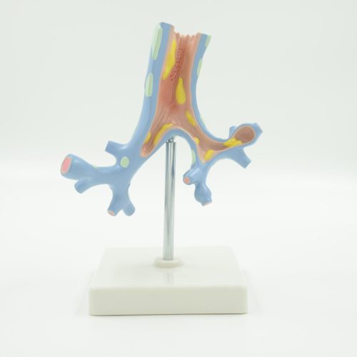 PATHOLOGICAL MODEL OF BRONCHIA