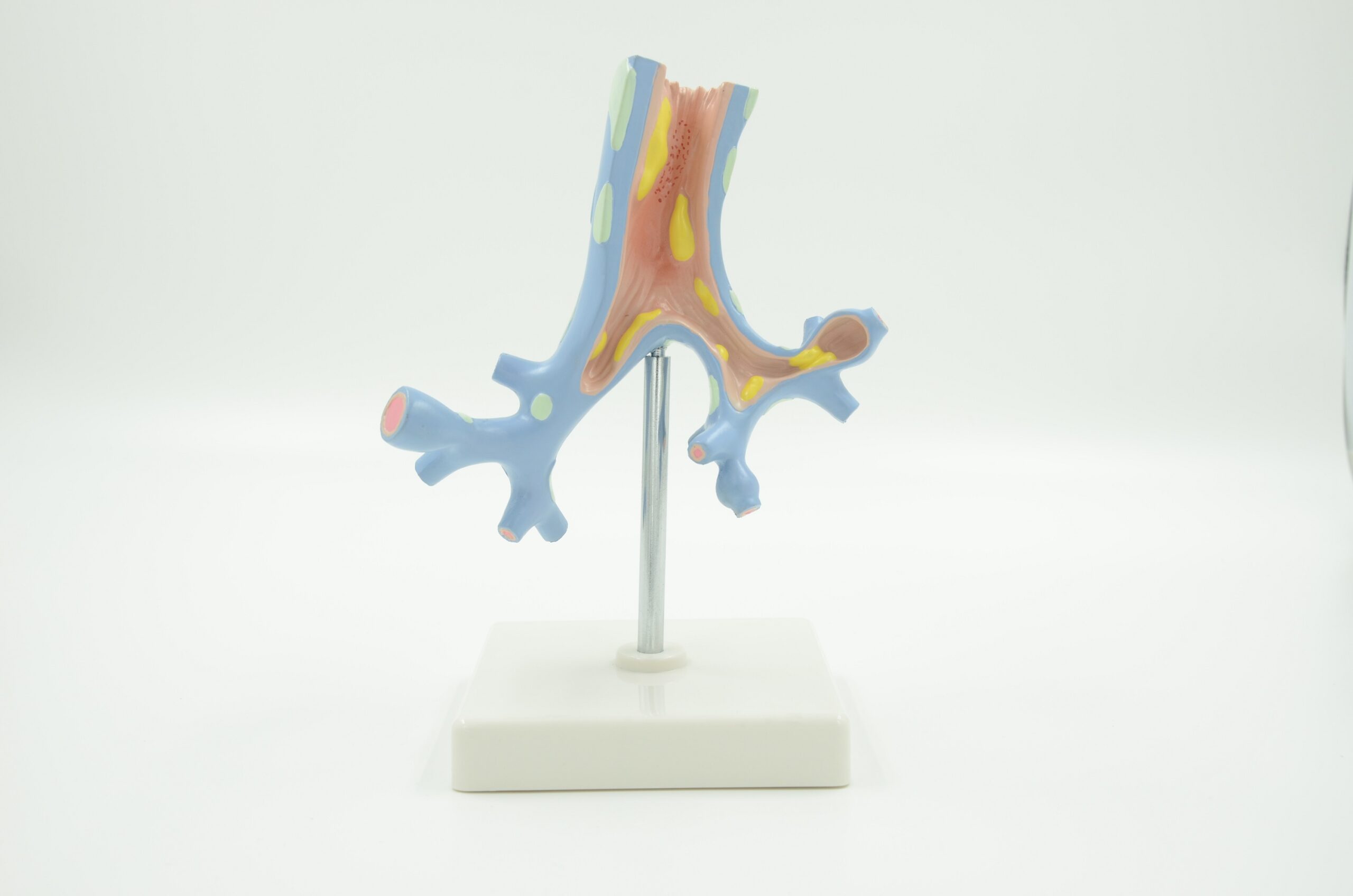 PATHOLOGICAL MODEL OF BRONCHIA