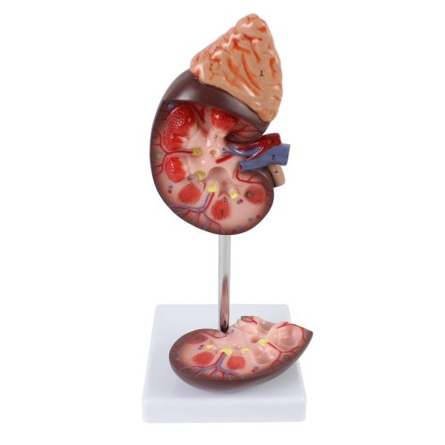 KIDNEY WITH ADRENAL GLAND 1.5X ENLARGED