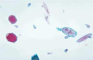 Educational Mixed Ciliates 30ML/Jar