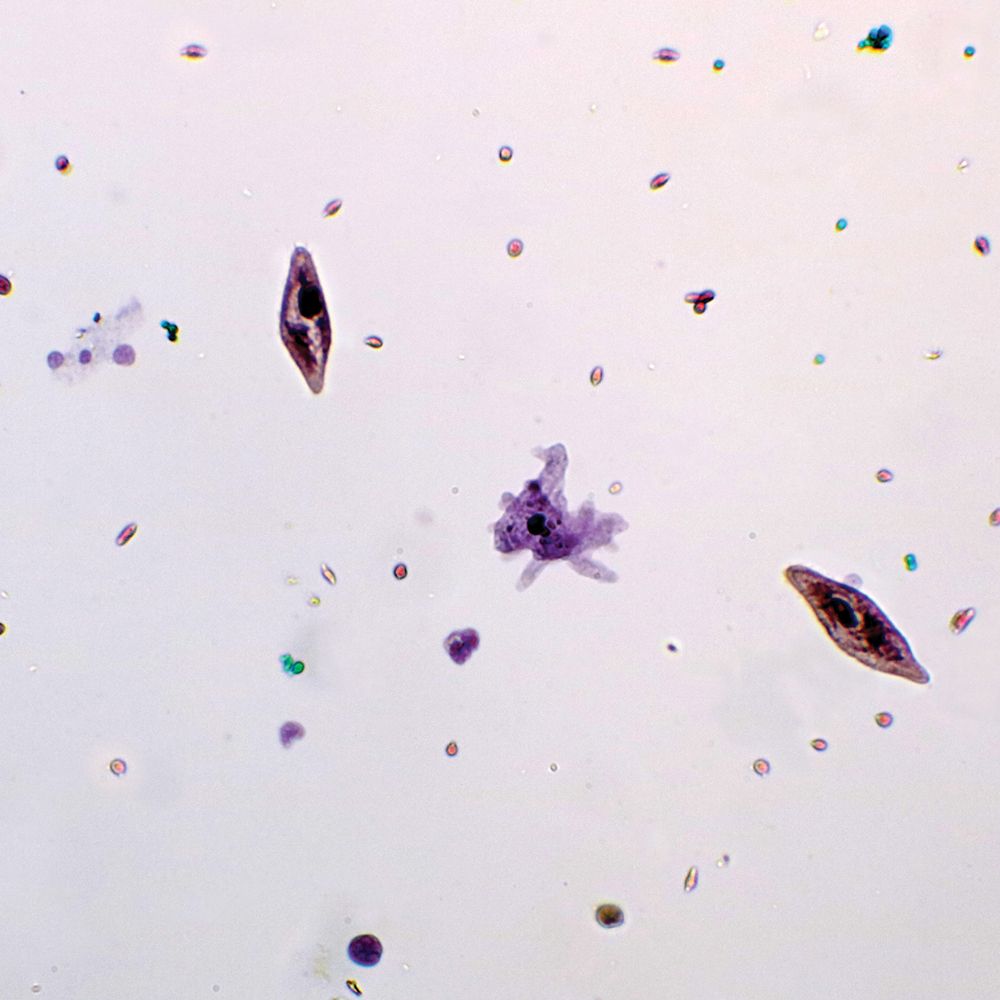 Mixed Protozoan Pellets Cultures